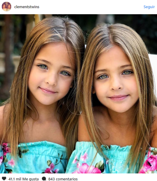 Ces Jumeaux Identiques Nes En 07 Ont Grandi Et Ont Ete Choisis Comme Les Plus Beaux Jumeaux Du Monde Entier Un Jour De Reve